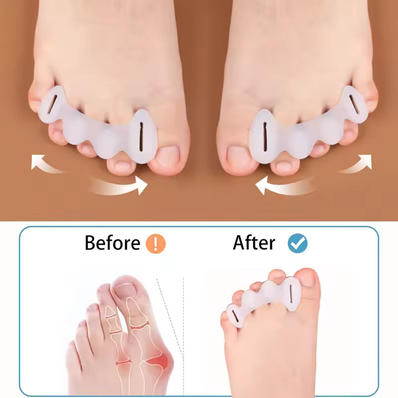 Hard Silicone Toe Separator for Bunion Relief - Buns.